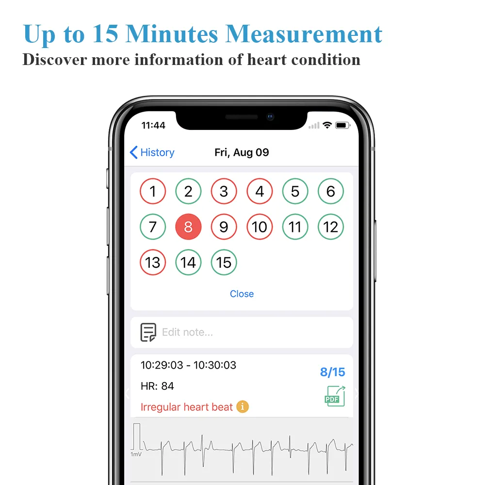 Portable ECG Monitor